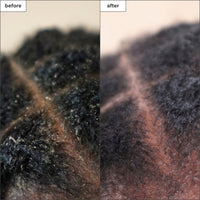 Traitement du cuir chevelu au charbon de bois et à l'arbre à thé Scalp Revival