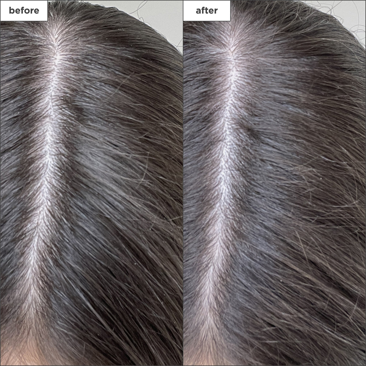 Shampoing Sec au Charbon + Biotine Scalp Revival