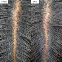 Scalp Revival Charcoal + Tea Tree Cooling Hydration Scalp Mask